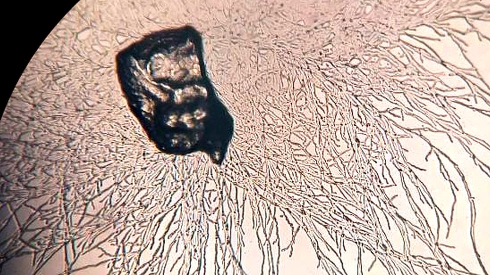 Bacteria Digests Plastic Under The Microscope