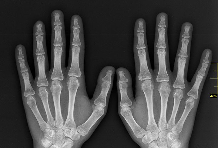 X Rays Can Get Very Expensive