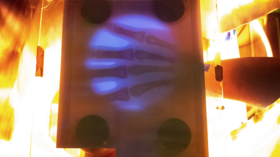 After Being Charged $70,000 By Hospital, He Makes His Own X-Ray Machine